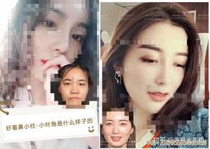 网红 鼻 哪里,从审美到整形，探寻流行趋势背后的秘密