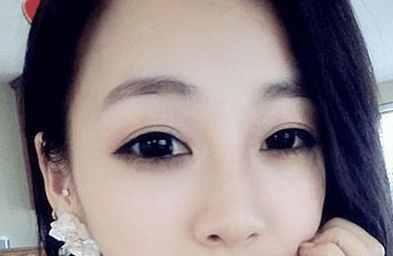 平行式双眼皮的明星,平行式双眼皮的风采与魅力